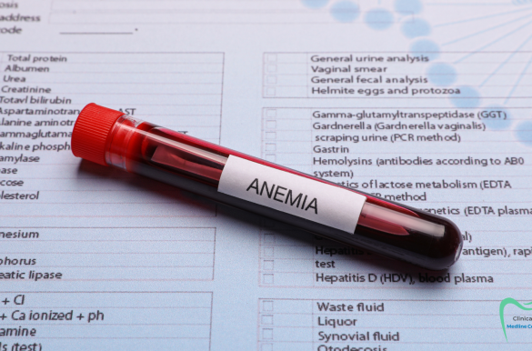 Anemia cu deficit de fier la copii